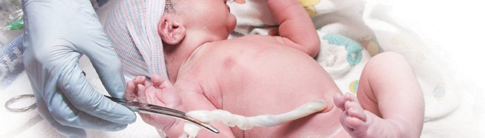 About Cord Tissue